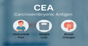 Medical infographic showing CEA Test (Carcinoembryonic Antigen) with three main symptoms of high CEA levels: abdominal pain, weight loss, and bowel changes.