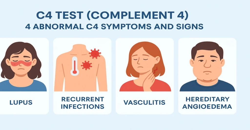 Infographic showing four abnormal C4 symptoms and signs – Lupus, Recurrent Infections, Vasculitis, and Hereditary Angioedema – related to low complement 4 levels.
