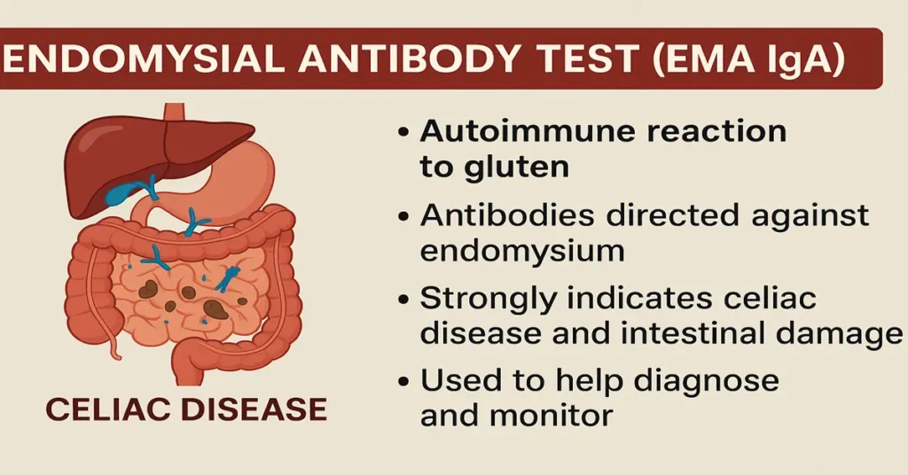 EMA IgA endomysial antibody test infographic showing celiac disease intestines and key autoimmune reaction points.